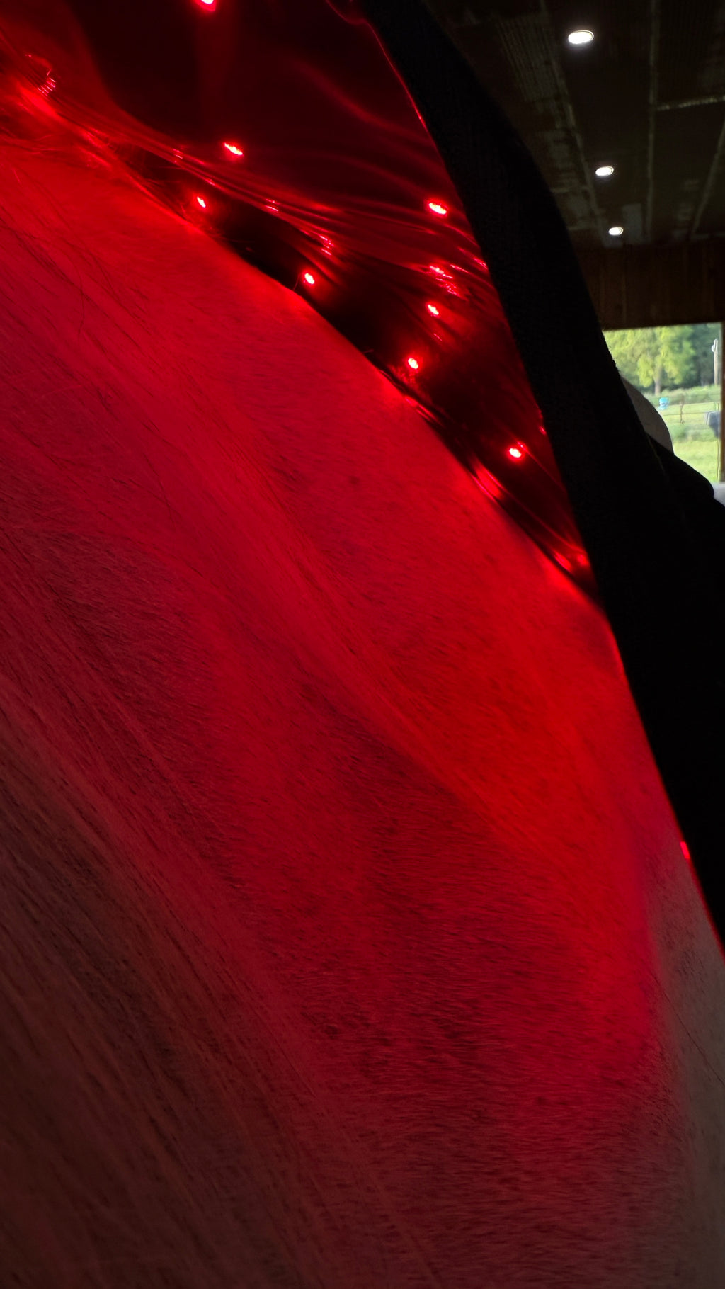 FYNX™ IGNITE Pro Back System